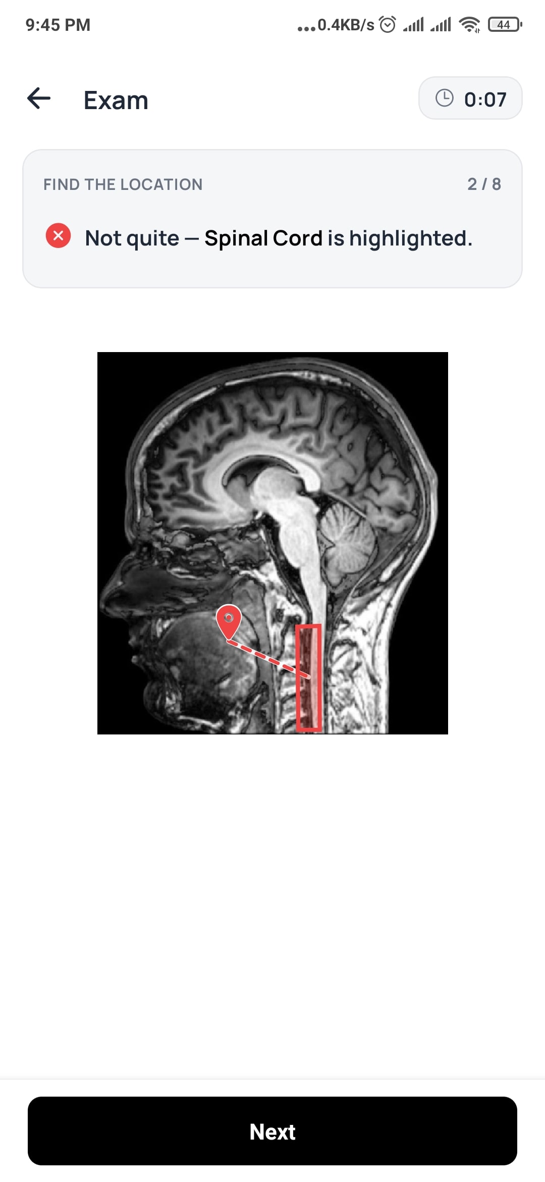 A tap-the-location exam on an MRI scan, marking an incorrect answer on the spinal cord